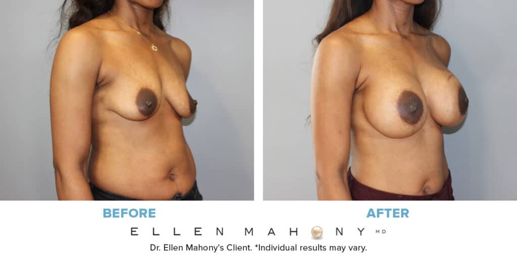 Before and After Image: Case #13696 - right-front-oblique