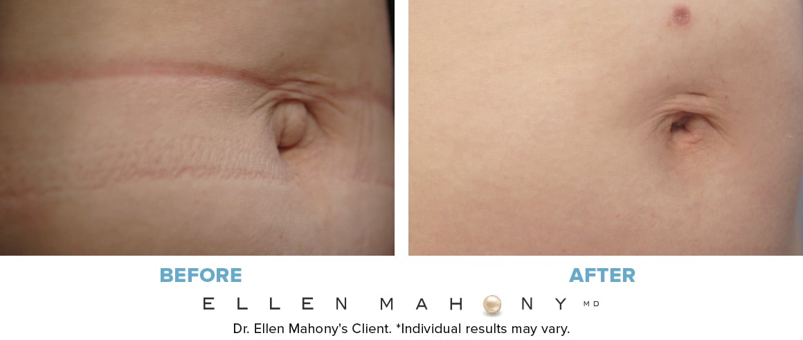 Before and After Image: Case #9561 - right-front-oblique