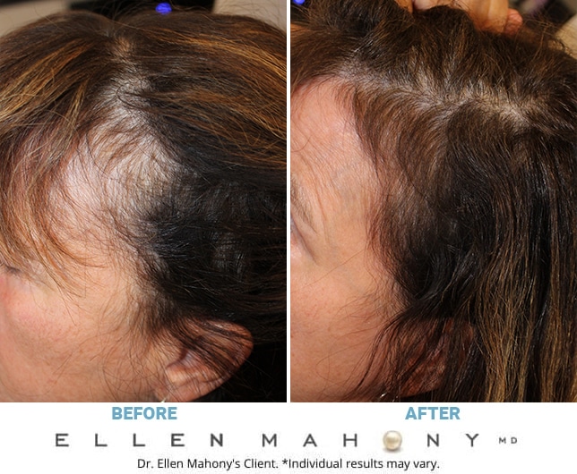 Before and After Image: Case #10799 - left-side
