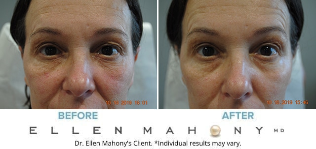 Before and After Image: Case #7458 - front