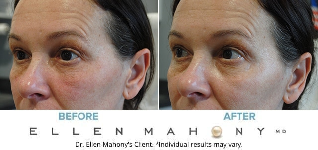 Before and After Image: Case #7458 - left-front-oblique