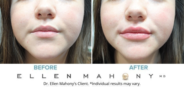 Before and After Image: Case # 8839 - front