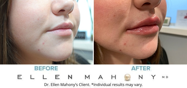 Before and After Image: Case # 8839 - right-front-oblique