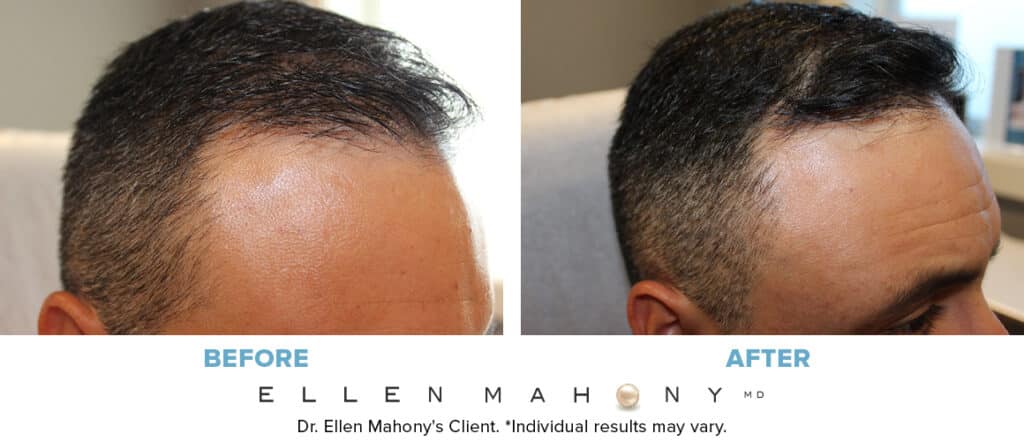 Before and After Image: Case #14030 - right-front-oblique