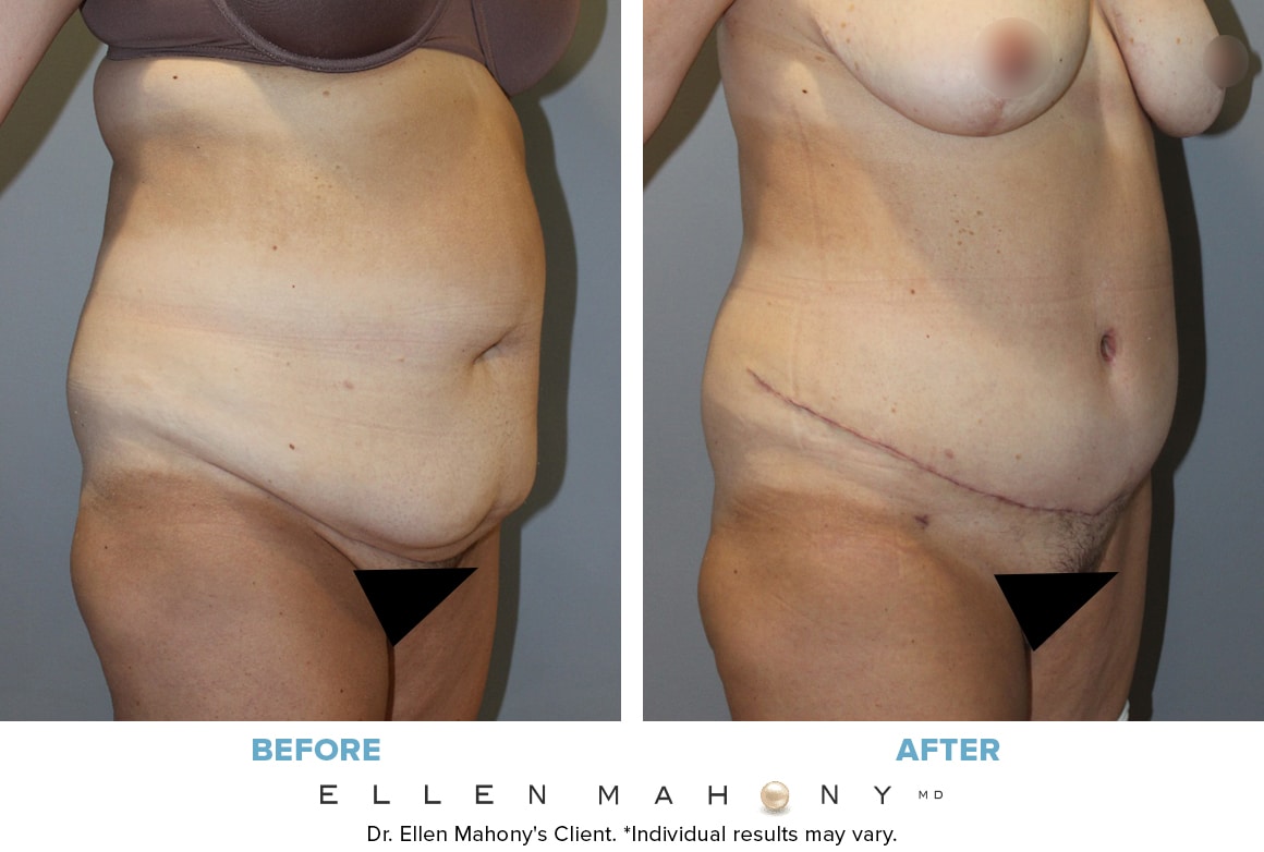 Before and After Image: Case #6582 - right-front-oblique