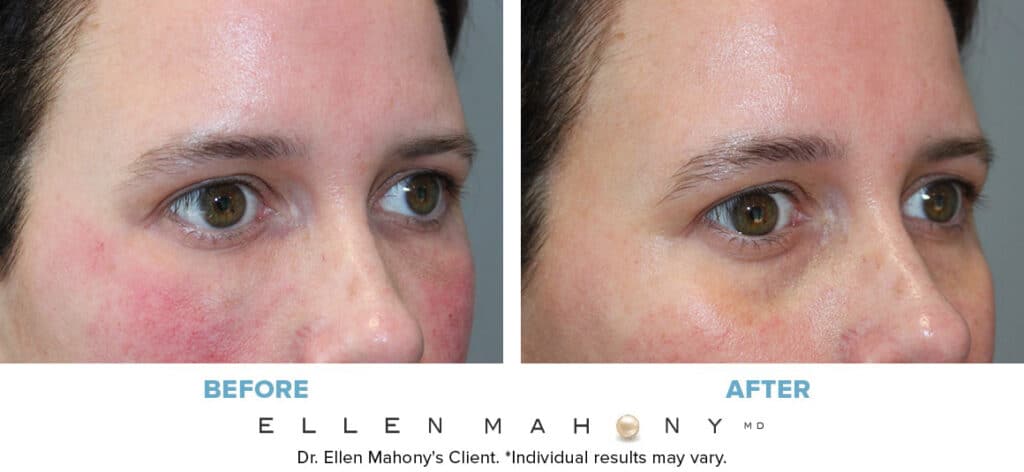 Before and After Image: Case #13690 - right-front-oblique