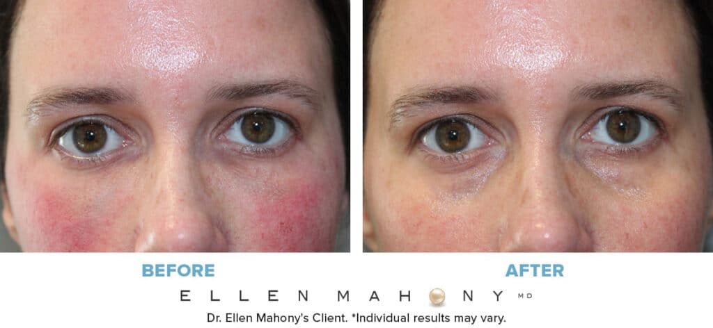 Before and After Image: Case #13690 - left-front-oblique