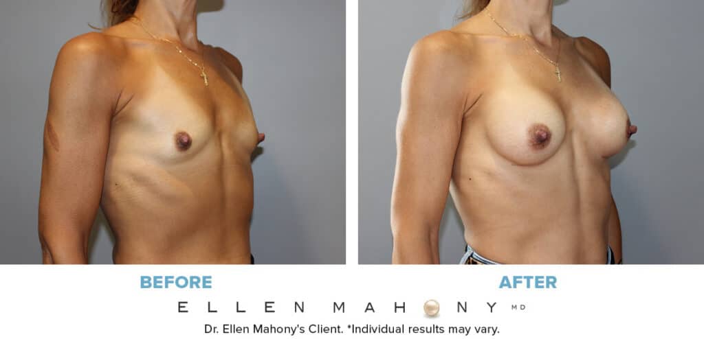 Before and After Image: Case #13971 - right-front-oblique