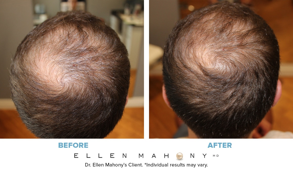 Before and After Image: Case #13761 - front