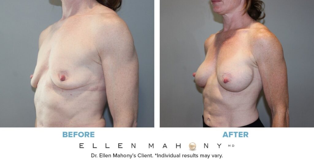 Before and After Image: Case #13678 - left-front-oblique