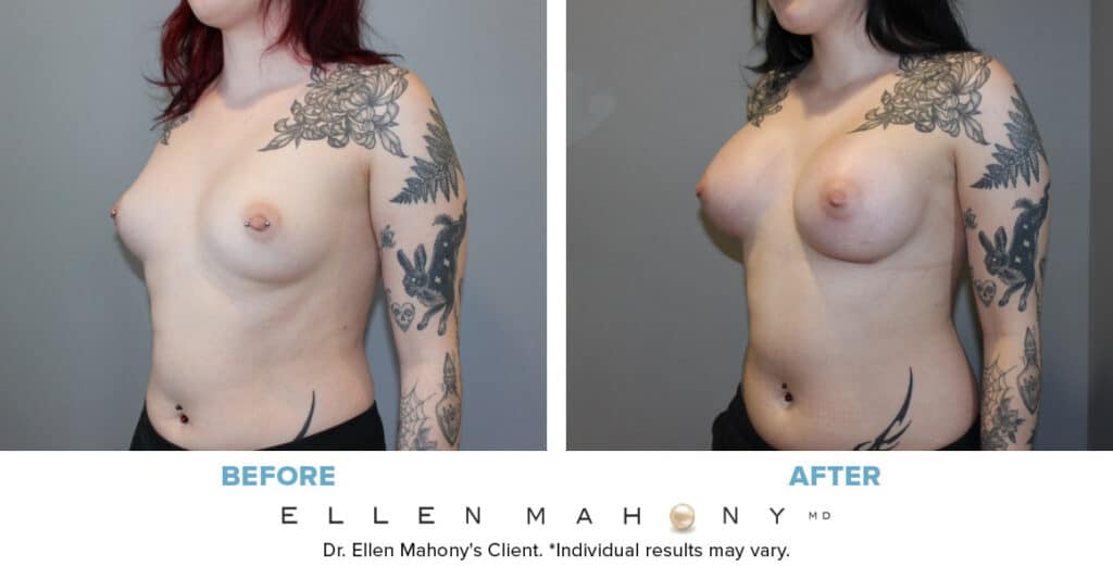 Before and After Image: Case #13520 - left-front-oblique