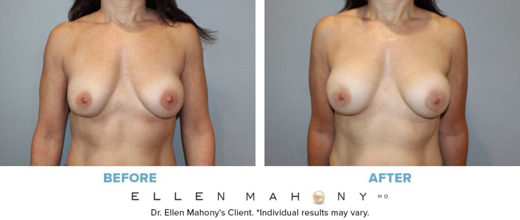 Before and After Image: Case #7184 - front