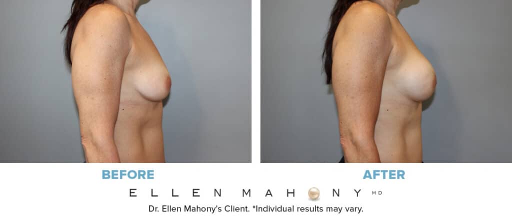 Before and After Image: Case #7184 - right-side