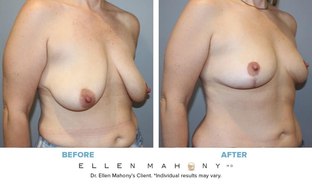 Before and After Image: Case #13836 - right-front-oblique