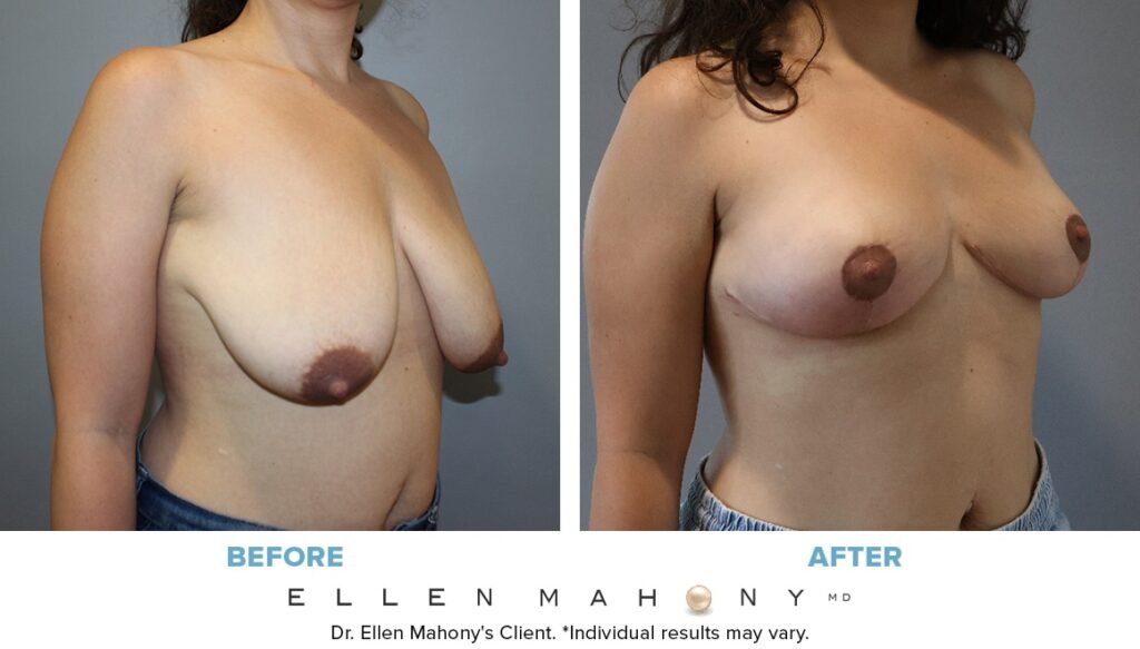 Before and After Image: Case #12761 - right-front-oblique