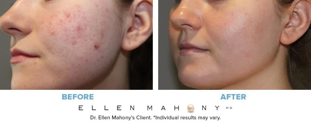 Before and After Image: Case #13130 - left-front-oblique