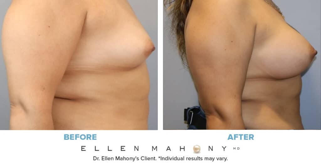 Before and After Image: Case #14769 - right-side