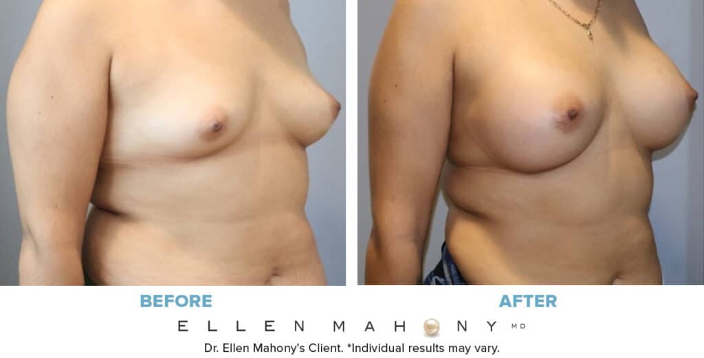 Before and After Image: Case #14769 - right-front-oblique