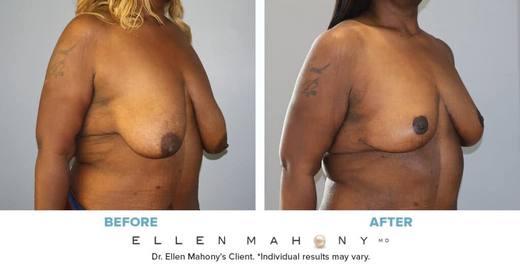 Before and After Image: Case #14589 - right-front-oblique