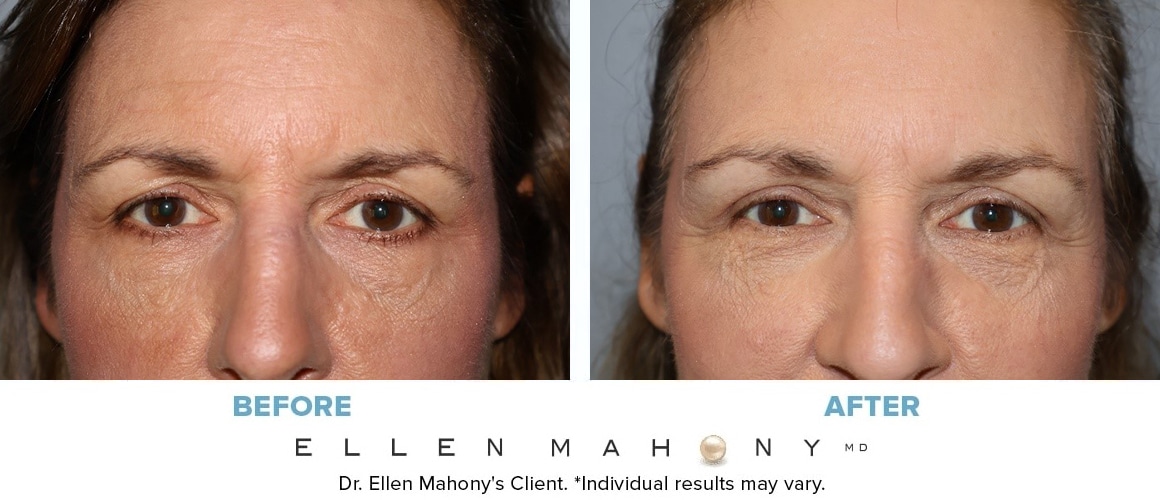 Before and After Image: Case #14799 - front