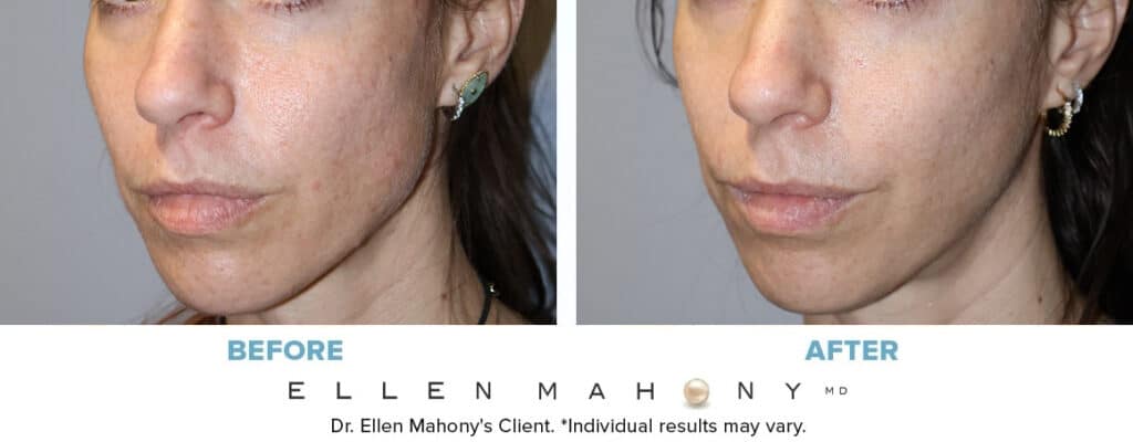 Before and After Image: Case #14991 - left-front-oblique