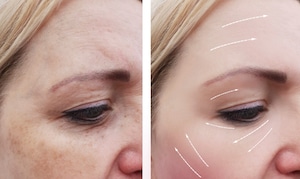 Face Procedures in Westport, CT