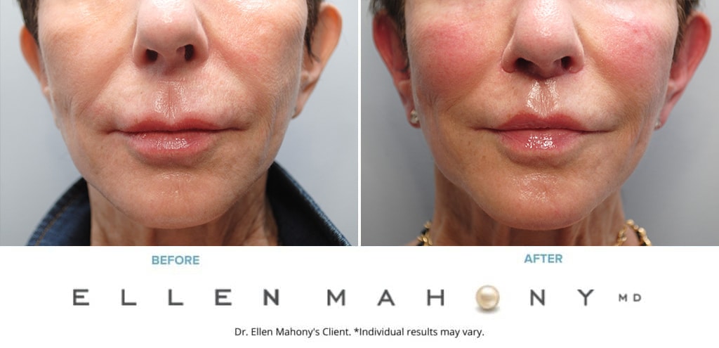 Before and After Image: Case #9876 - front