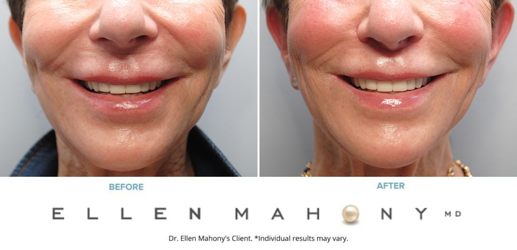 Before and After Image: Case #9876 - front