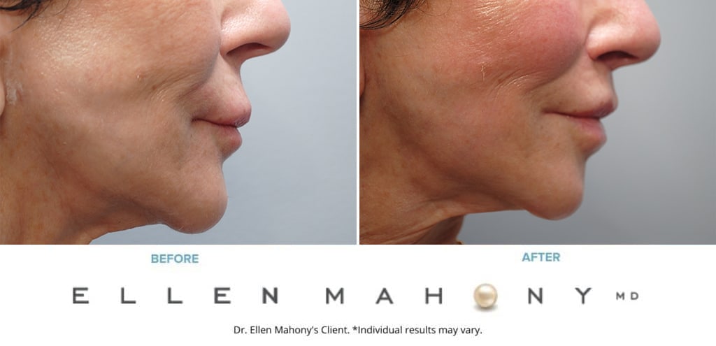 Before and After Image: Case #9876 - right-side