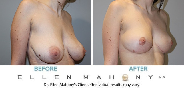 Before and After Image: Case #10419 - right-front-oblique