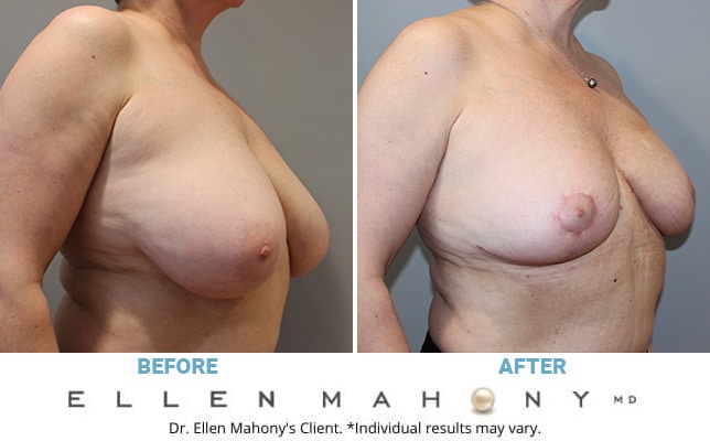 Before and After Image: Case #10377 - right-front-oblique