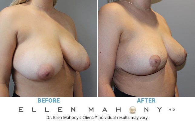 Before and After Image: Case #10794 - right-front-oblique