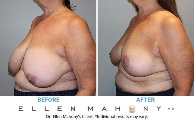 Before and After Image: Case #10799 - left-front-oblique