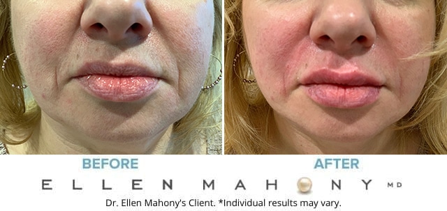 Before and After Image: Case #8196 - front