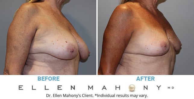 Before and After Image: Case #10781 - right-front-oblique
