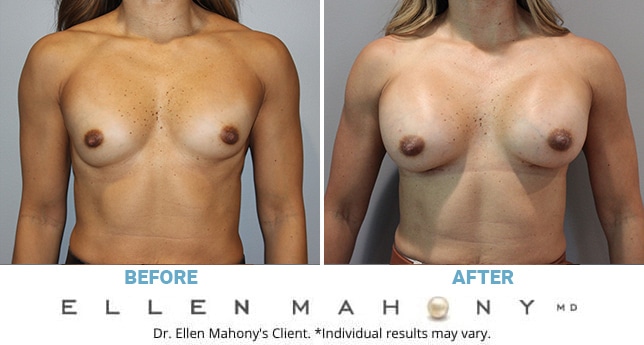 Before and After Image: Case #10832 - front