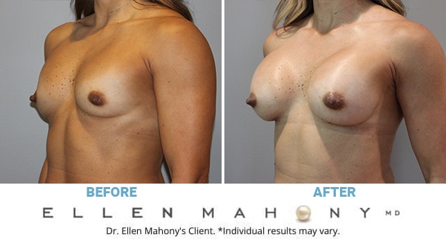 Before and After Image: Case #10832 - left-front-oblique