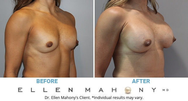 Before and After Image: Case #10832 - right-front-oblique