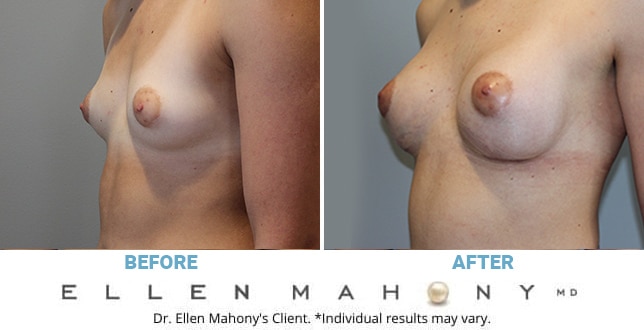 Before and After Image: Case #10188 - left-front-oblique