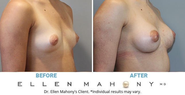 Before and After Image: Case #10188 - right-front-oblique