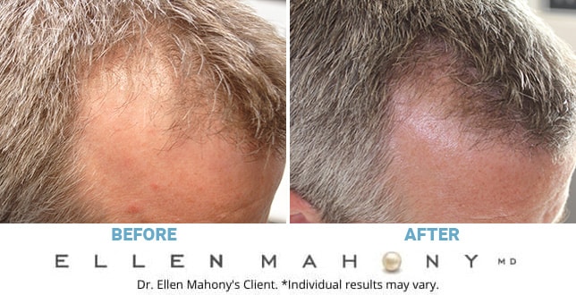 Before and After Image: Case #10024 - right-front-oblique