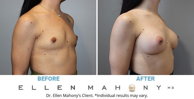 Before and After Image: Case #10923 - right-front-oblique
