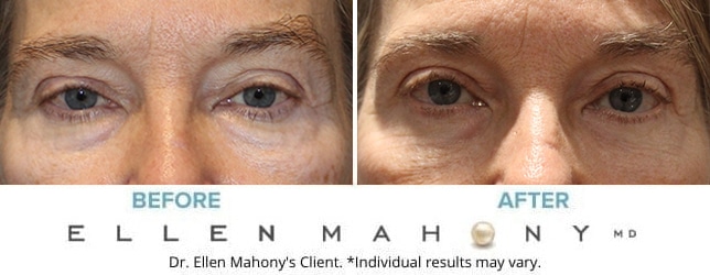 Before and After Image: Case #10512 - front