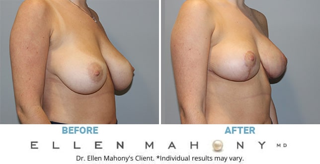 Before and After Image: Case #11219 - right-front-oblique