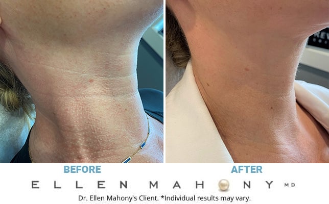 Before and After Image: Case #3228 - right-front-oblique