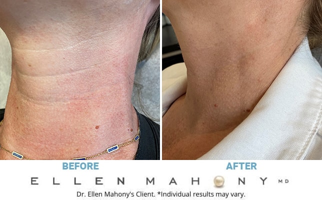 Before and After Image: Case #3228 - left-front-oblique