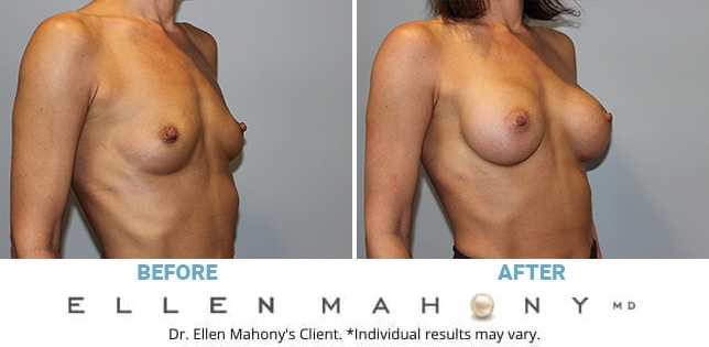Before and After Image: Case #11777 - right-front-oblique