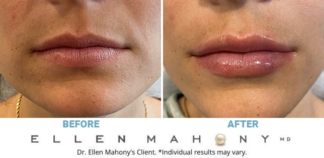 Before and After Image: Case #10519 - front