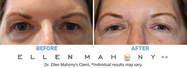 Before and After Image: Case #10645 - front