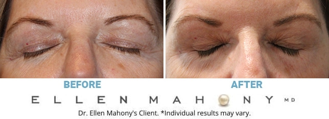 Before and After Image: Case #10645 - front